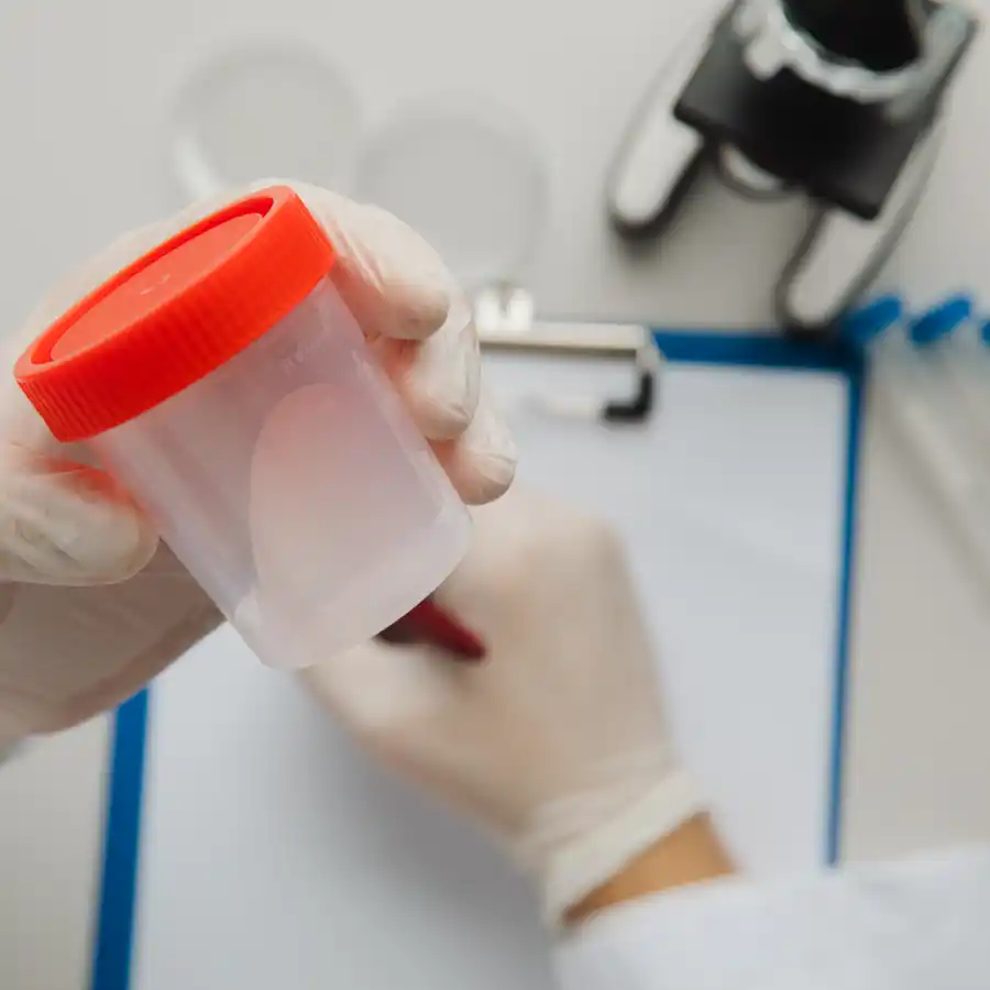 SEMINOGRAMA (ESPERMATOBIOSCOPIA DIRECTA)